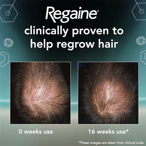 Regaine